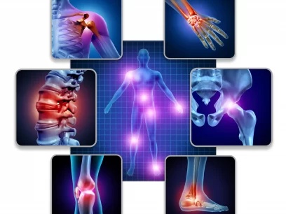 Different body joints suffering from arthritic pain