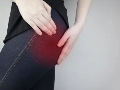 Painful buttock with Piriformis Syndrome in need of being treated by an osteopath.
