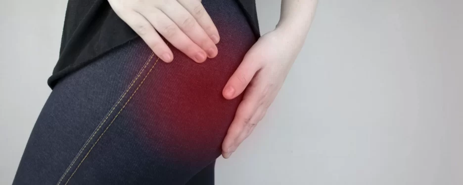 Painful buttock with Piriformis Syndrome in need of being treated by an osteopath.