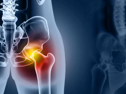 Hip pain in need of osteopathic treatment and massage