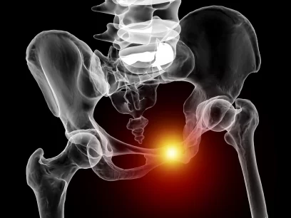 Pubic Symphysis Dysfunction Can Be Treated With Osteopathy