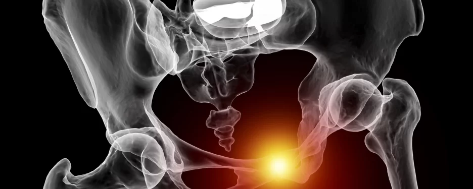 Pubic Symphysis Dysfunction Can Be Treated With Osteopathy